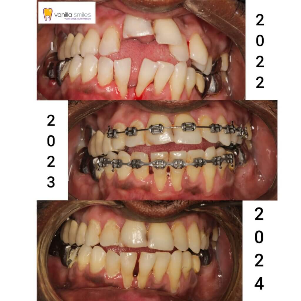 Ortho Treated