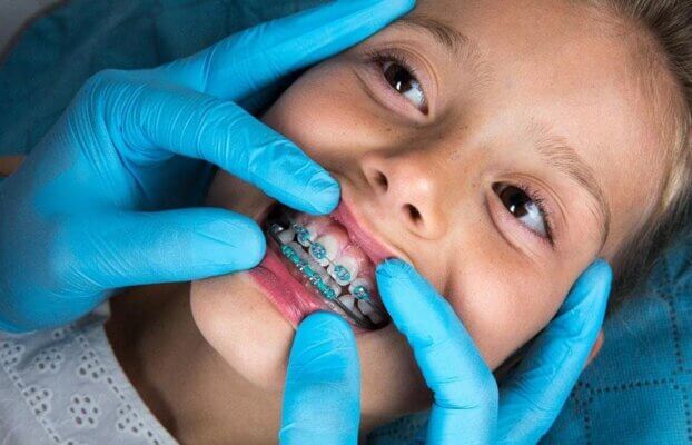 Expert Tips for Maintaining Your Child’s Oral Health: From Baby Teeth to Braces at Vanilla Smiles Dental Clinic