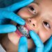 Pediatric Dentist In Pune