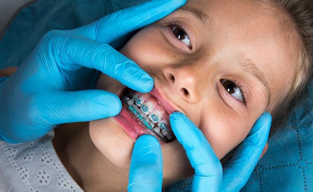 Expert Tips for Maintaining Your Child’s Oral Health: From Baby Teeth to Braces at Vanilla Smiles Dental Clinic