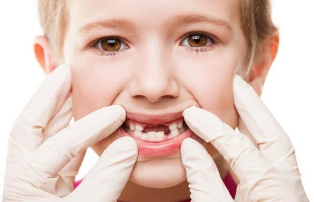 How to Prevent Cavities in Kids: Dentist-Approved Tips by Top Pediatric Dentist in Pune – Dr. Abhishek Soni