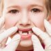 Pediatric Dentist in Pune