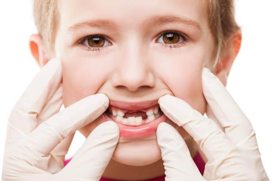 How to Prevent Cavities in Kids: Dentist-Approved Tips by Top Pediatric Dentist in Pune – Dr. Abhishek Soni